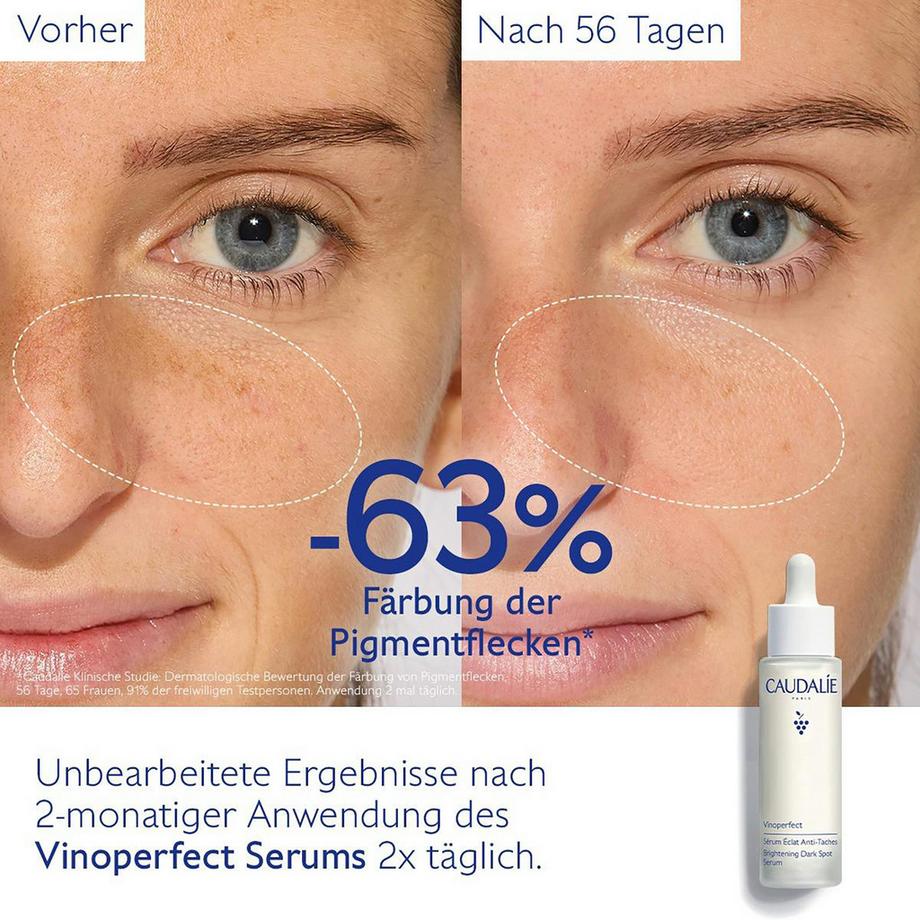 CAUDALIE OS Vinoperfect sérum anti tâch Vinoperfect Siero illuminante Anti-macchie  