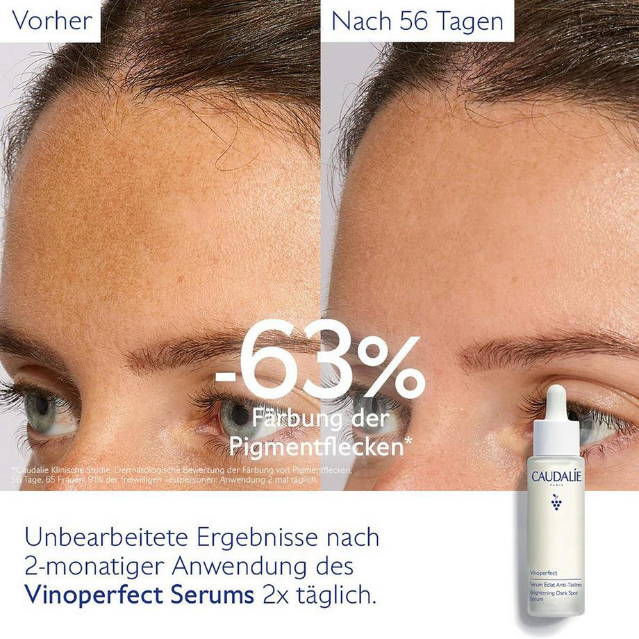 CAUDALIE OS Vinoperfect sérum anti tâch Vinoperfect Siero illuminante Anti-macchie  