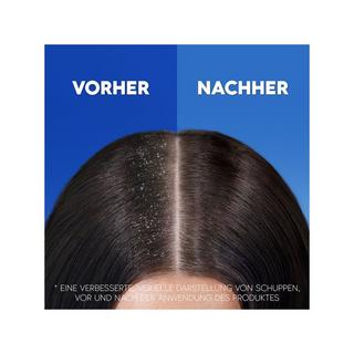 head & shoulders  Shampoo anti-caduta antiforfora 