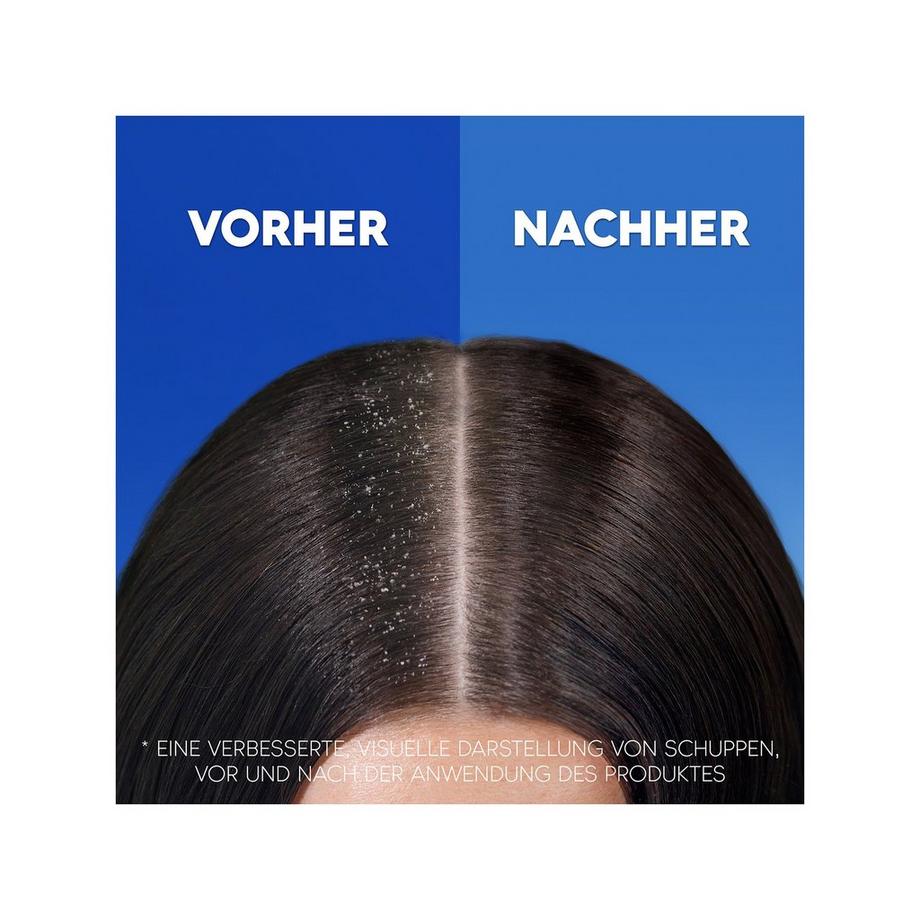 head & shoulders  Anti-Haarverlust Anti-Schuppen-Shampoo 