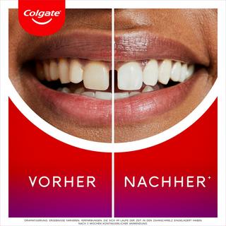 Colgate  Max White Ultimate Radiance Dentifrice 