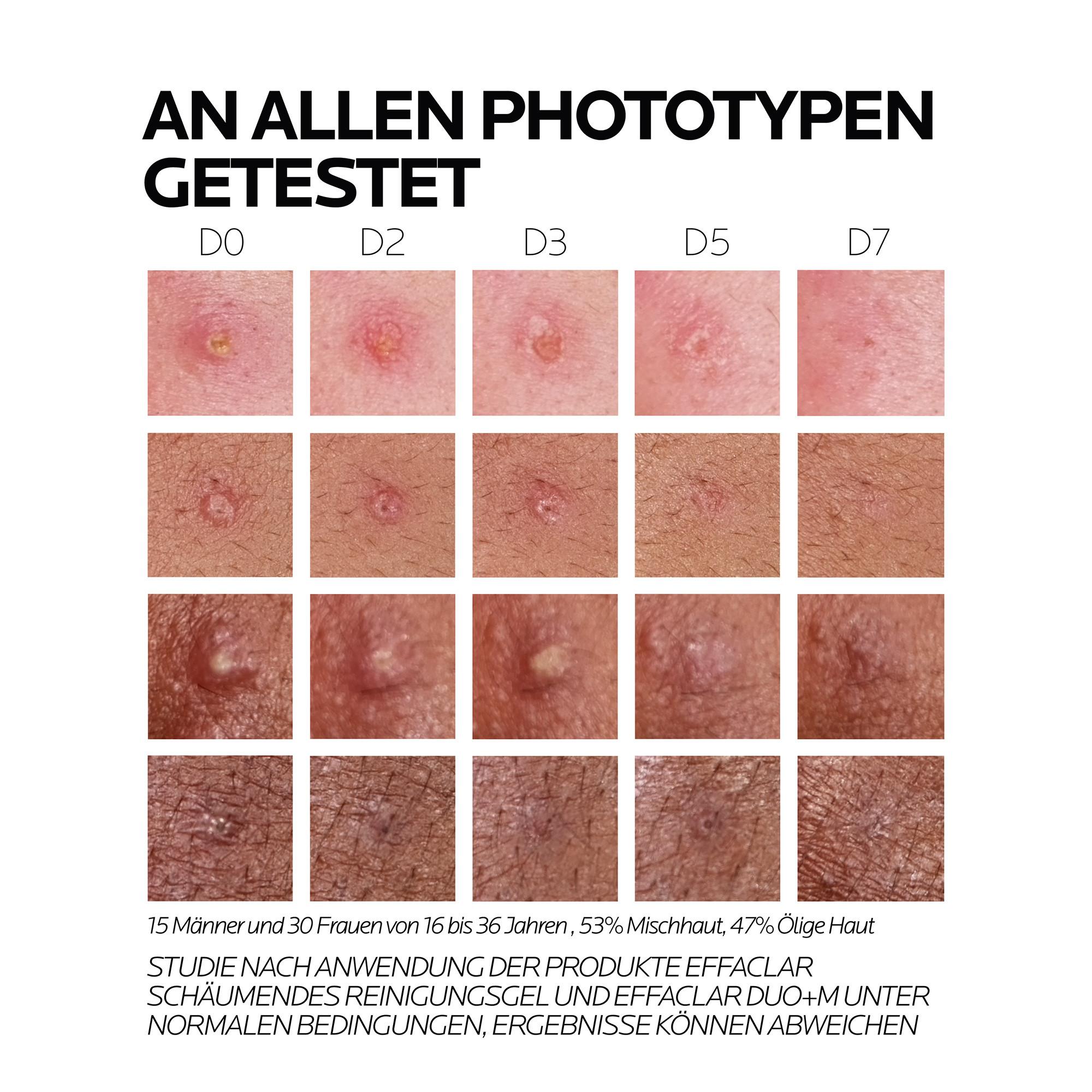 LA ROCHE POSAY  Effaclar Duo+M Dreifach Tiefenwirksame Pflege Gegen Unreinheiten 