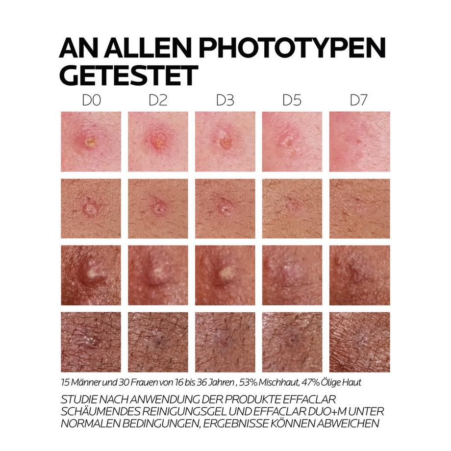 LA ROCHE POSAY  Effaclar Duo+M Soin triple action en profondeur Contre les imperfections 