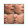 FIRST AID BEAUTY  Ultra Repair Cream - Intensive Feuchtigkeitscreme für Gesicht und Körper 