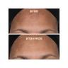 FIRST AID BEAUTY  Facial Radiance Niacinamide Dark Spot Serum - Serum gegen Pigmentflecken 