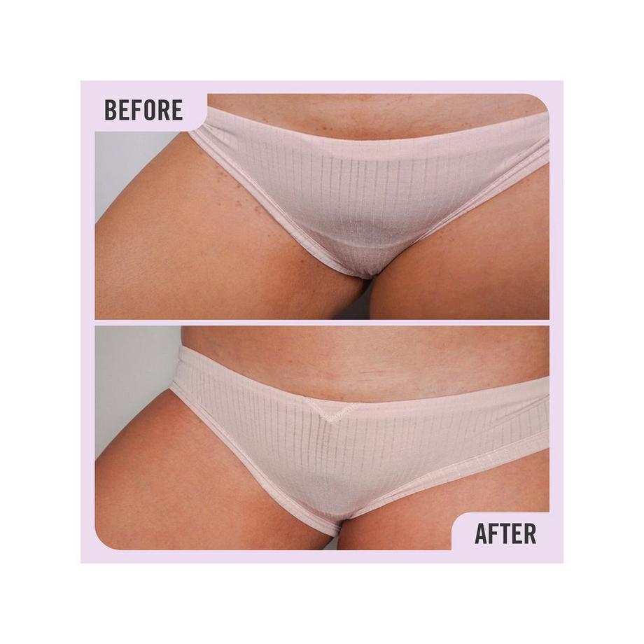 FIRST AID BEAUTY  Ingrown Hair Pads - Disques Pour Poils Incarnés aux BHA & AHA  