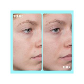 FIRST AID BEAUTY  10% Vitamin C Brightening Serum - Siero illuminante con il 10% di vitamina C 