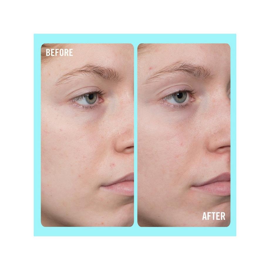 FIRST AID BEAUTY  10% Vitamin C Brightening Serum - Sérum Illuminateur avec 10% de Vitamine C  