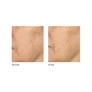 Dr Dennis Gross Alpha Beta®  Peeling Quotidien Formule Universelle 