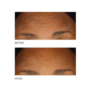 Dr Dennis Gross Alpha Beta®  Peeling Quotidien Formule Intense 