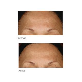 Dr Dennis Gross Alpha Beta®  Extra Strength Daily Peel 