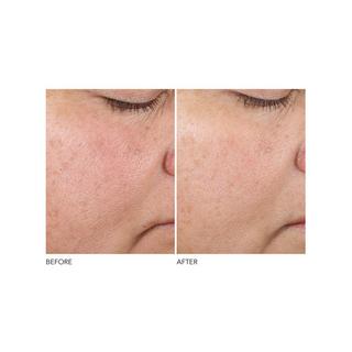 Dr Dennis Gross  Advanced Retinol + Ferulic - Sérum Concentré Redensifiant 