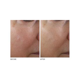 Dr Dennis Gross  Advanced Retinol + Ferulic - Sérum Concentré Redensifiant 