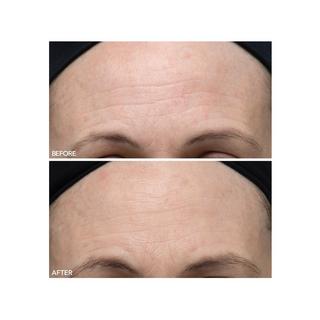 Dr Dennis Gross  Alpha Beta® - Peeling Quotidien Ultra-Douce 