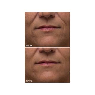 Dr Dennis Gross  Alpha Beta® - Peeling Quotidien Ultra-Douce 