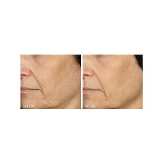 Dr Dennis Gross  Vitamin C + Lactic - Serum mit 15% Vitamin C Straffung und Strahlkraft 