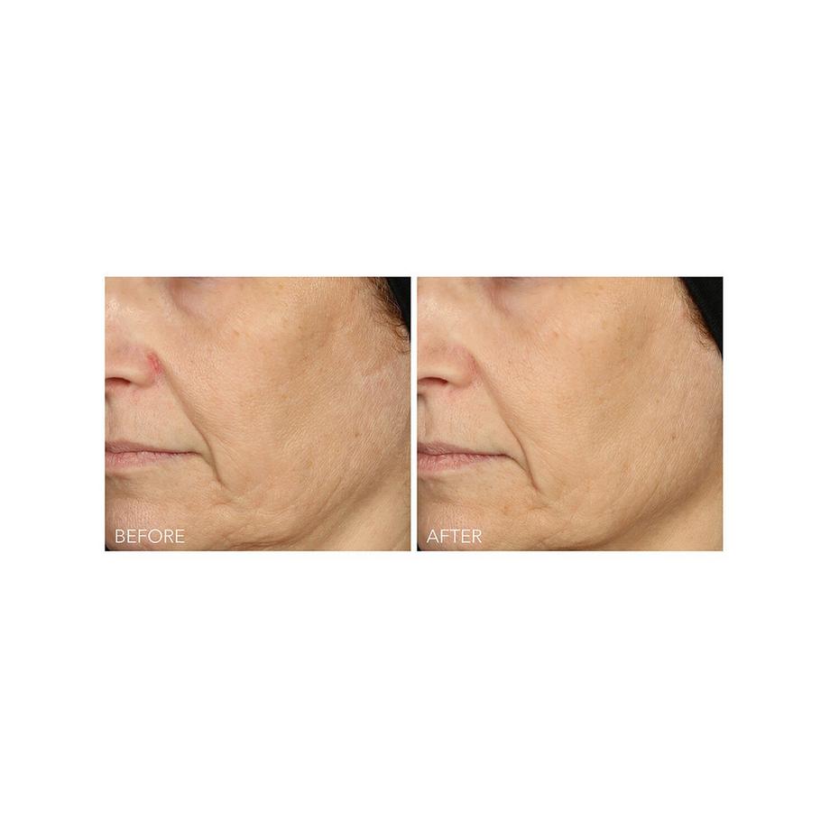 Dr Dennis Gross  Vitamin C + Lactic - Serum mit 15% Vitamin C Straffung und Strahlkraft 