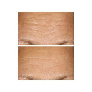 Dr Dennis Gross  Vitamin C + Lactic - Sérum Concentré 15% de Vitamine C Fermeté et éclat 