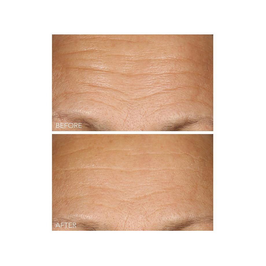 Dr Dennis Gross  Vitamin C + Lactic - Serum mit 15% Vitamin C Straffung und Strahlkraft 