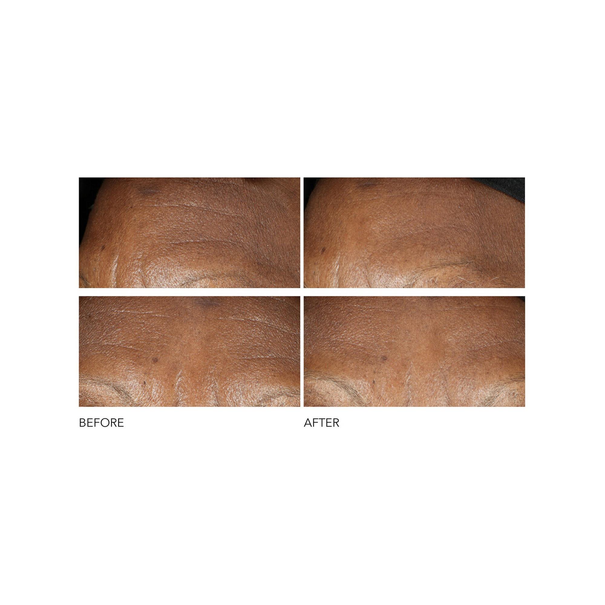 Dr Dennis Gross  Advanced Retinol + Ferulic - Crème Anti-Rides Intense 