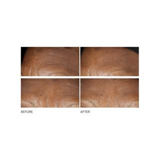 Dr Dennis Gross  Advanced Retinol + Ferulic - Crema antirughe intensiva 