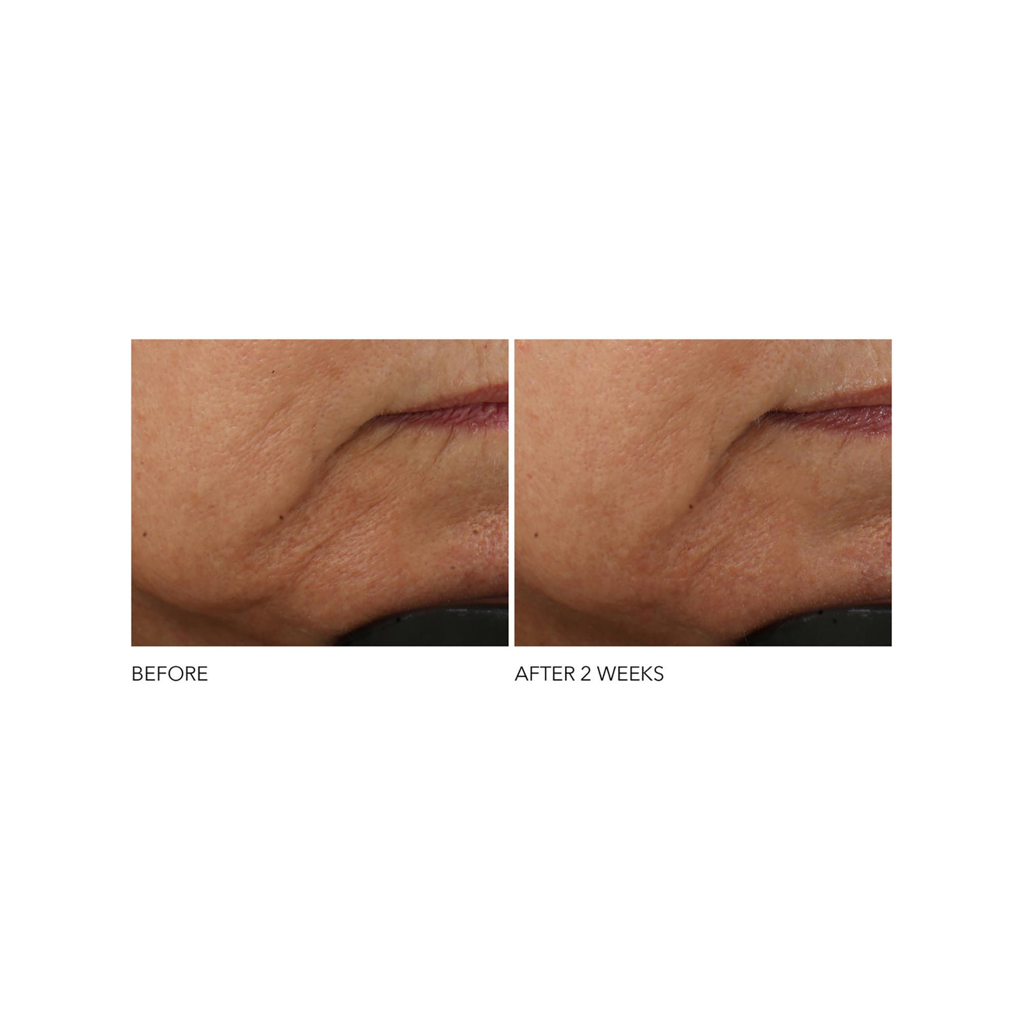 Dr Dennis Gross  Advanced Retinol + Ferulic - Crema antirughe intensiva 