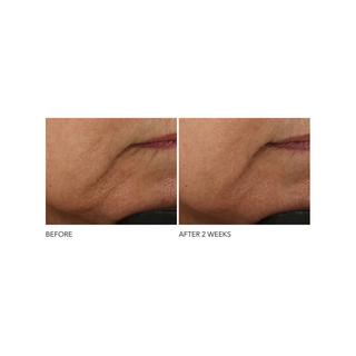 Dr Dennis Gross  Advanced Retinol + Ferulic - Intensive Anti-Falten-Creme 