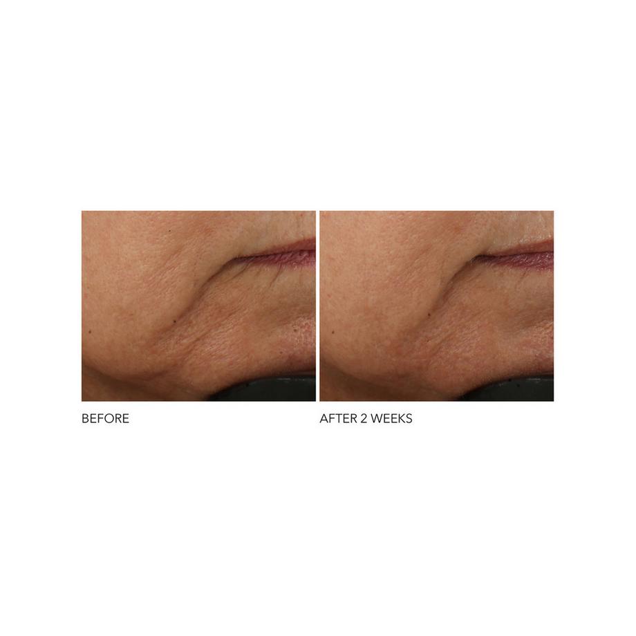 Dr Dennis Gross  Advanced Retinol + Ferulic - Intensive Anti-Falten-Creme 