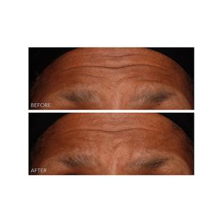 Dr Dennis Gross  DermInfusions™ Fill + Repair Serum - Gel zur schnellen Regeneration 