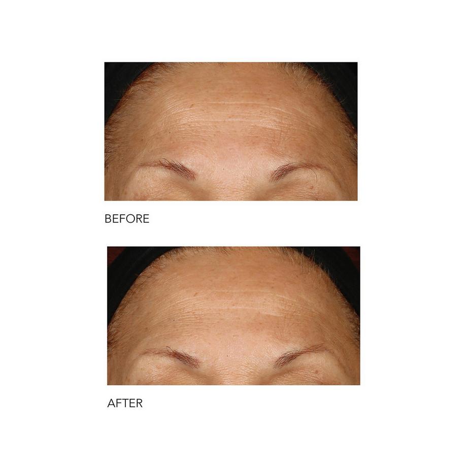 Dr Dennis Gross  Alpha Beta® Extra Strength Daily Peel 