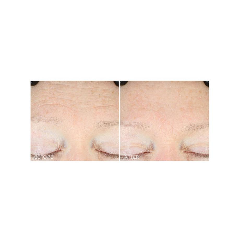 Dr Dennis Gross  Vitamin C + Lactic Oil-Free Radiant Moisturizer 