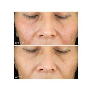 Dr Dennis Gross  Vitamin C + Lactic - Siero idratante 