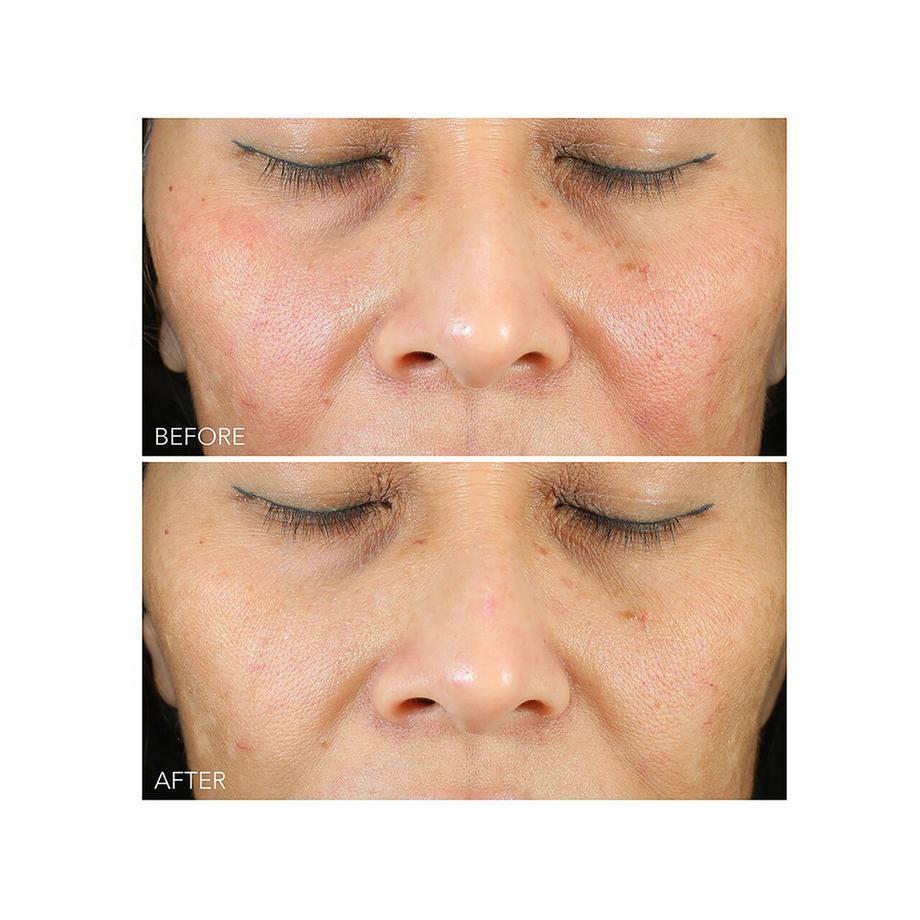 Dr Dennis Gross  Vitamin C + Lactic Oil-Free Radiant Moisturizer 