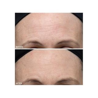 Dr Dennis Gross  Alpha Beta® - Ultramildes Peeling für den Alltag 