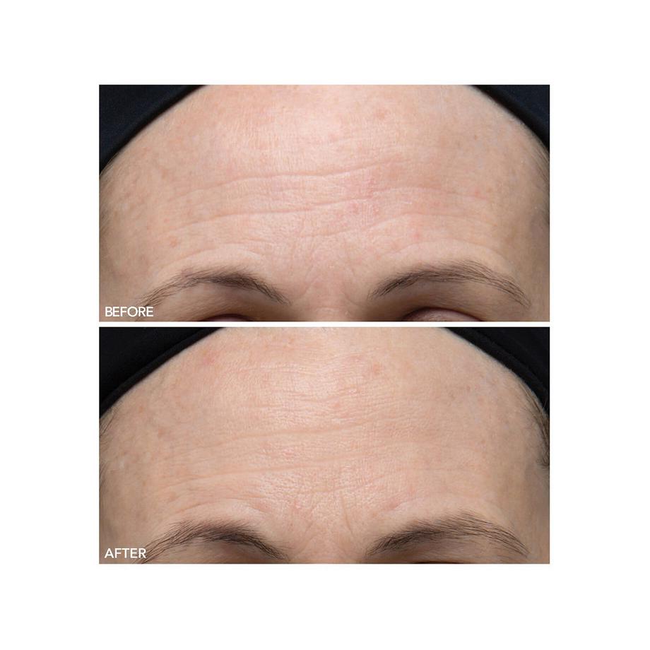 Dr Dennis Gross  Alpha Beta® - Ultramildes Peeling für den Alltag 