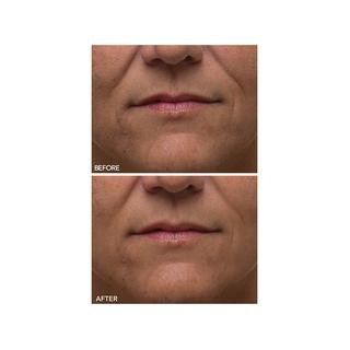 Dr Dennis Gross  Alpha Beta® - Peeling quotidiano ultra delicato 