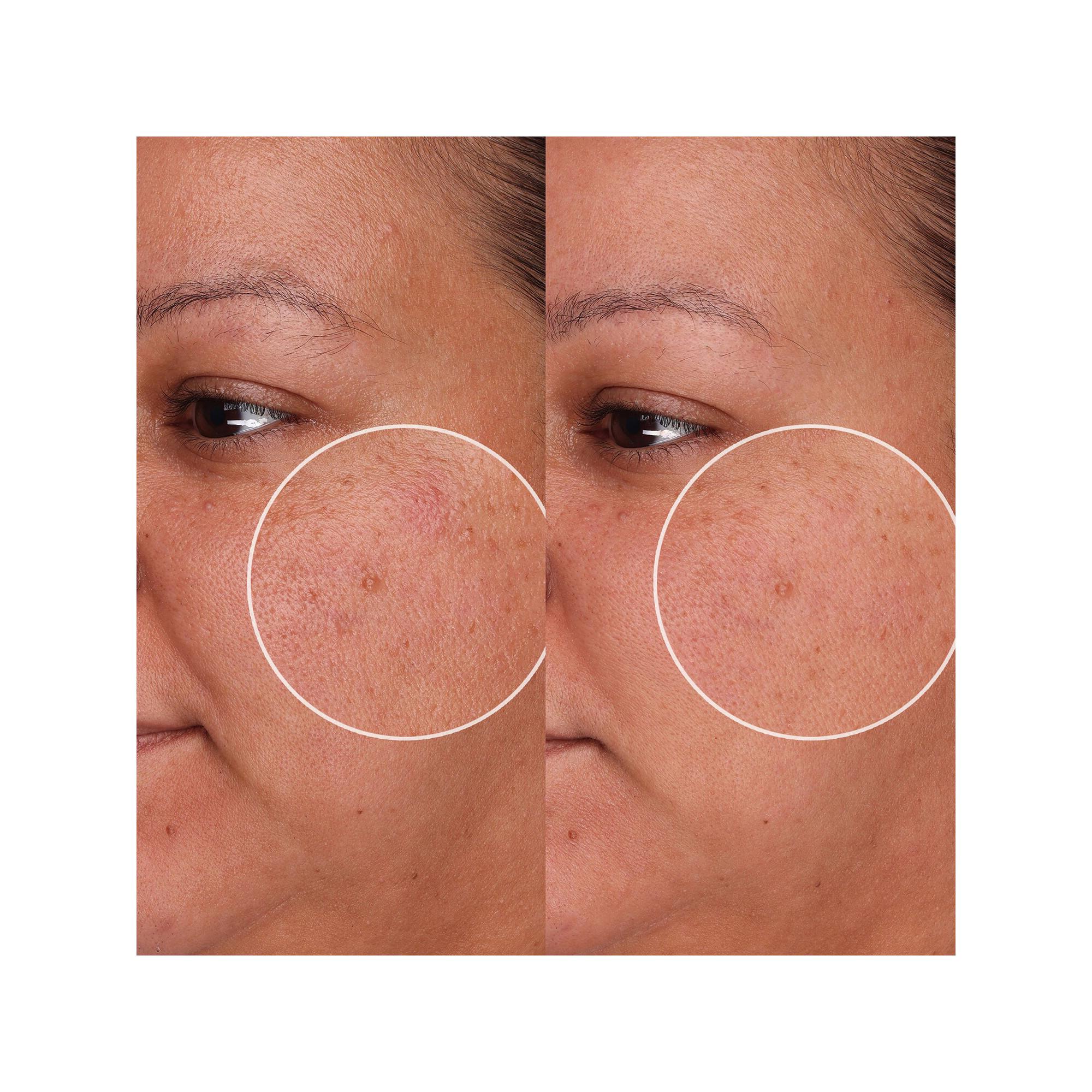 benefit  The POREfessional Wow Polish - Peelingpuder mit dreifacher Wirkung für die Poren 