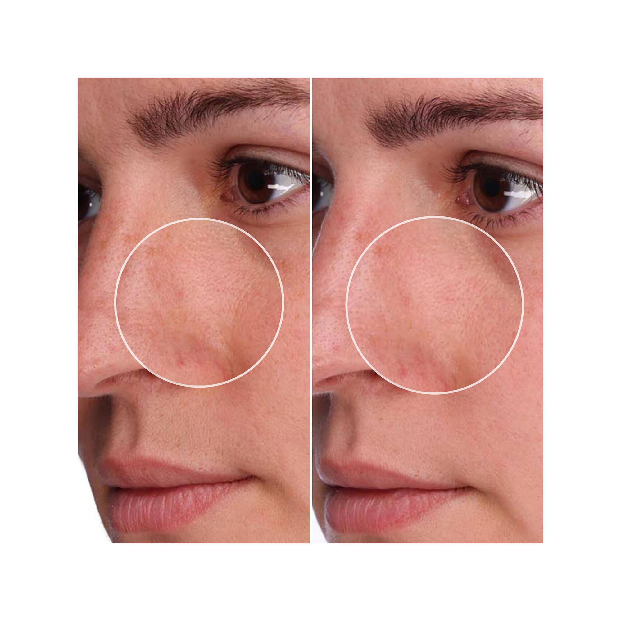 benefit  The POREfessional Shrink Wrap - Trattamento notte per i pori con AHA+PHA 