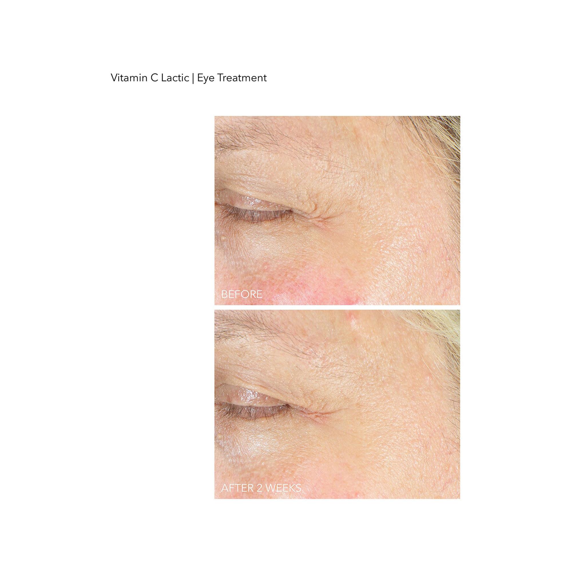 Dr Dennis Gross  Vitamin C Lactic - Soin Contour des Yeux Eclat 