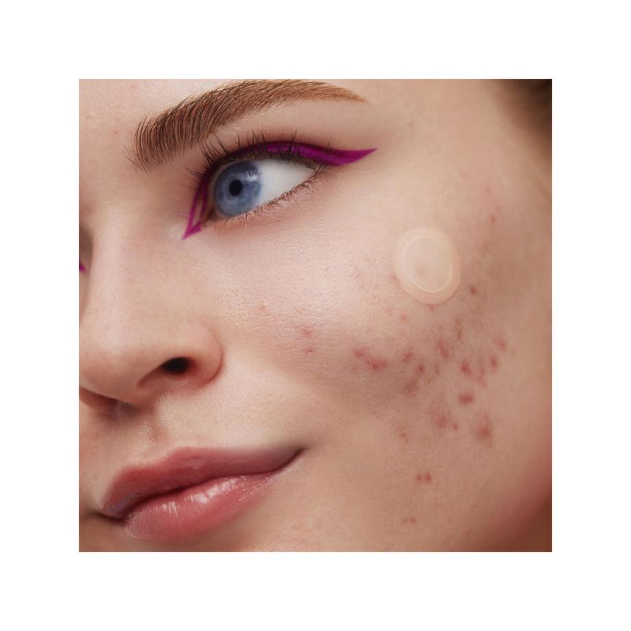 PEACE OUT SKINCARE  Cerotti per il trattamento dell'acne - Microneedling 