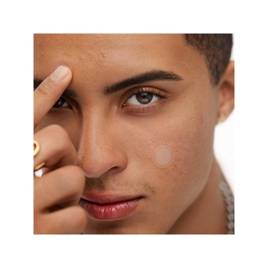 PEACE OUT SKINCARE  Cerotti per il trattamento dell'acne - Microneedling 