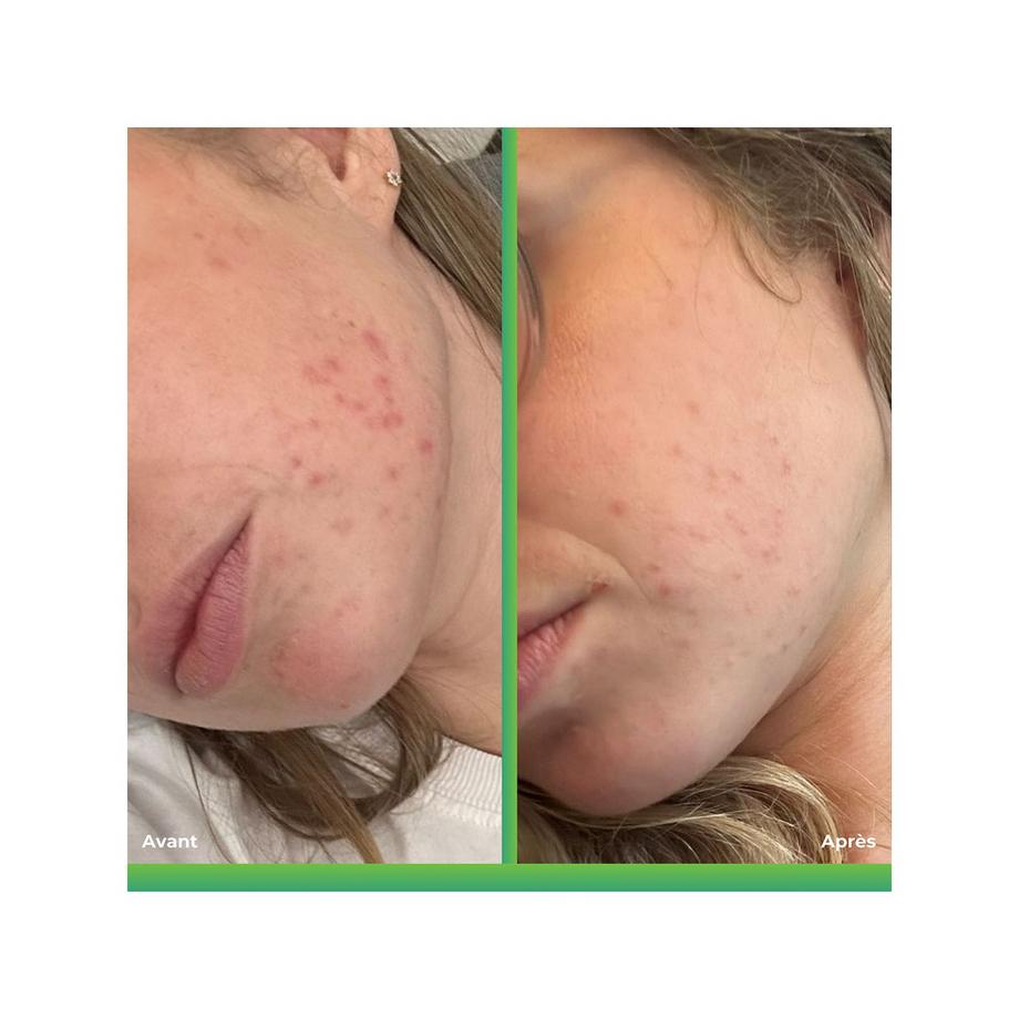 I.D. Swiss Botanicals Huile Régulatrice Imperfection Huile Régulatrice Imperfections 