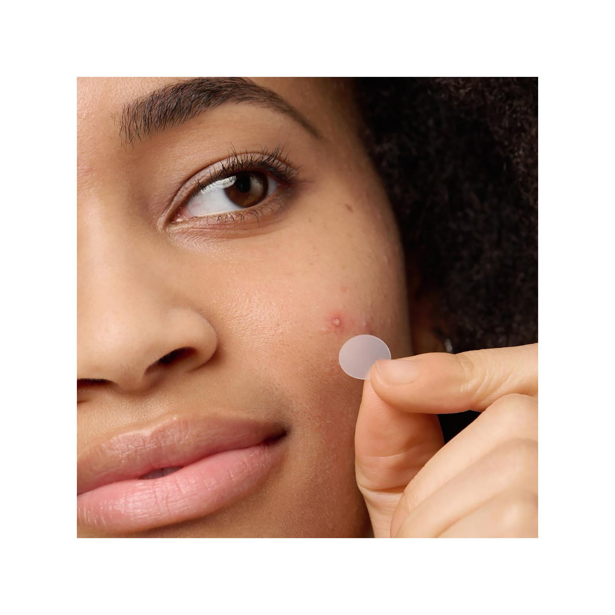 Hero.  Mighty Patch The Original 