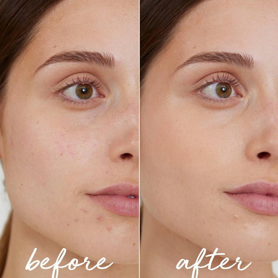 La Rosée  Stick Correcteur Teinté Anti-Imperfections  