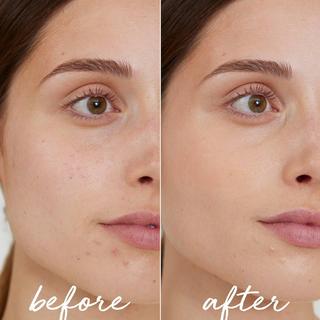 La Rosée  Recharge Stick Correcteur Teinté Anti-Imperfections  