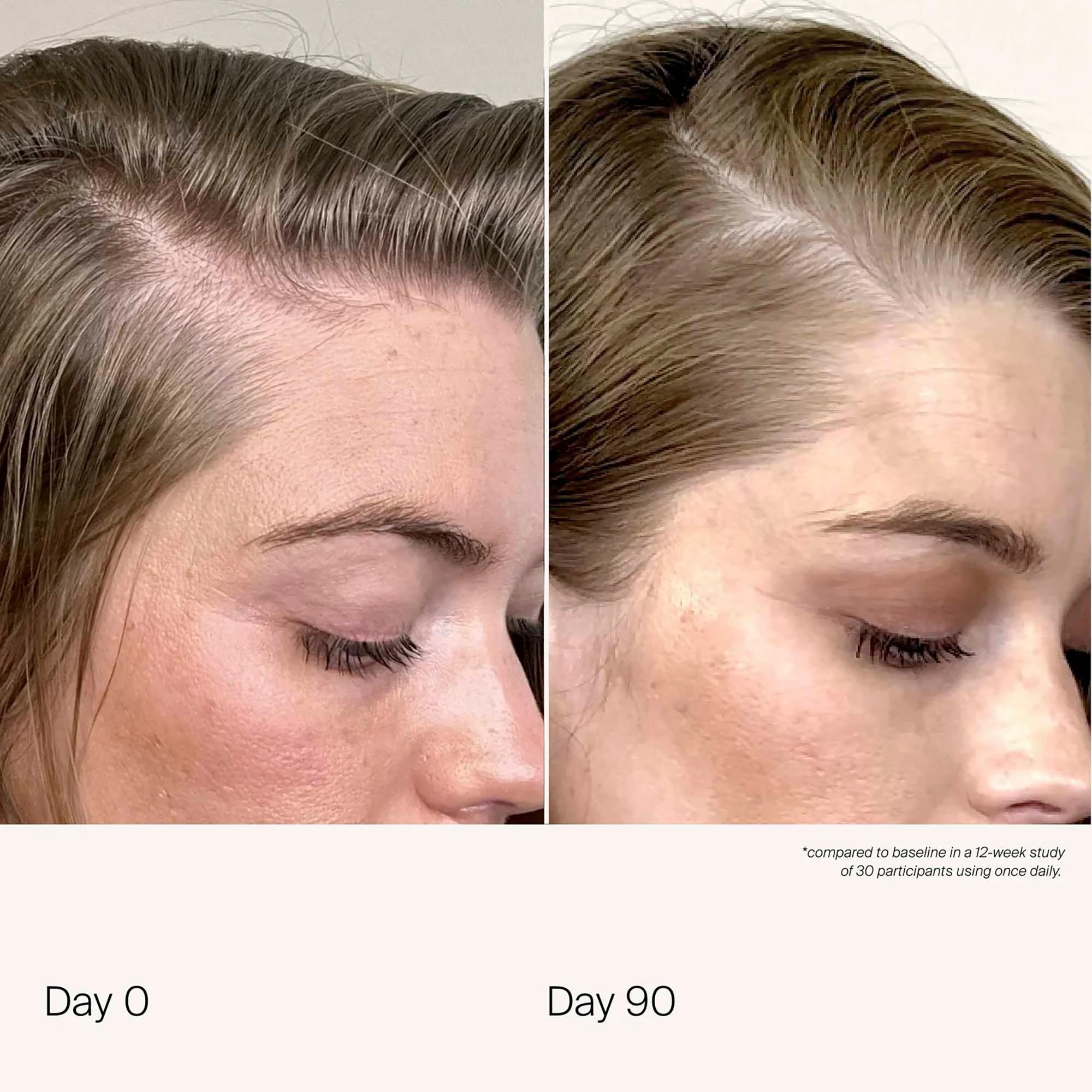 LIVING PROOF  Scalp Care Density Serum - Pflegebehandlung für die Kopfhaut 