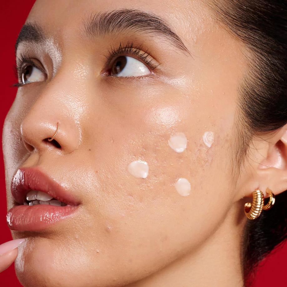 Yepoda  The Spot Stop – Soluzione anti imperfezioni con AHA+PHA 