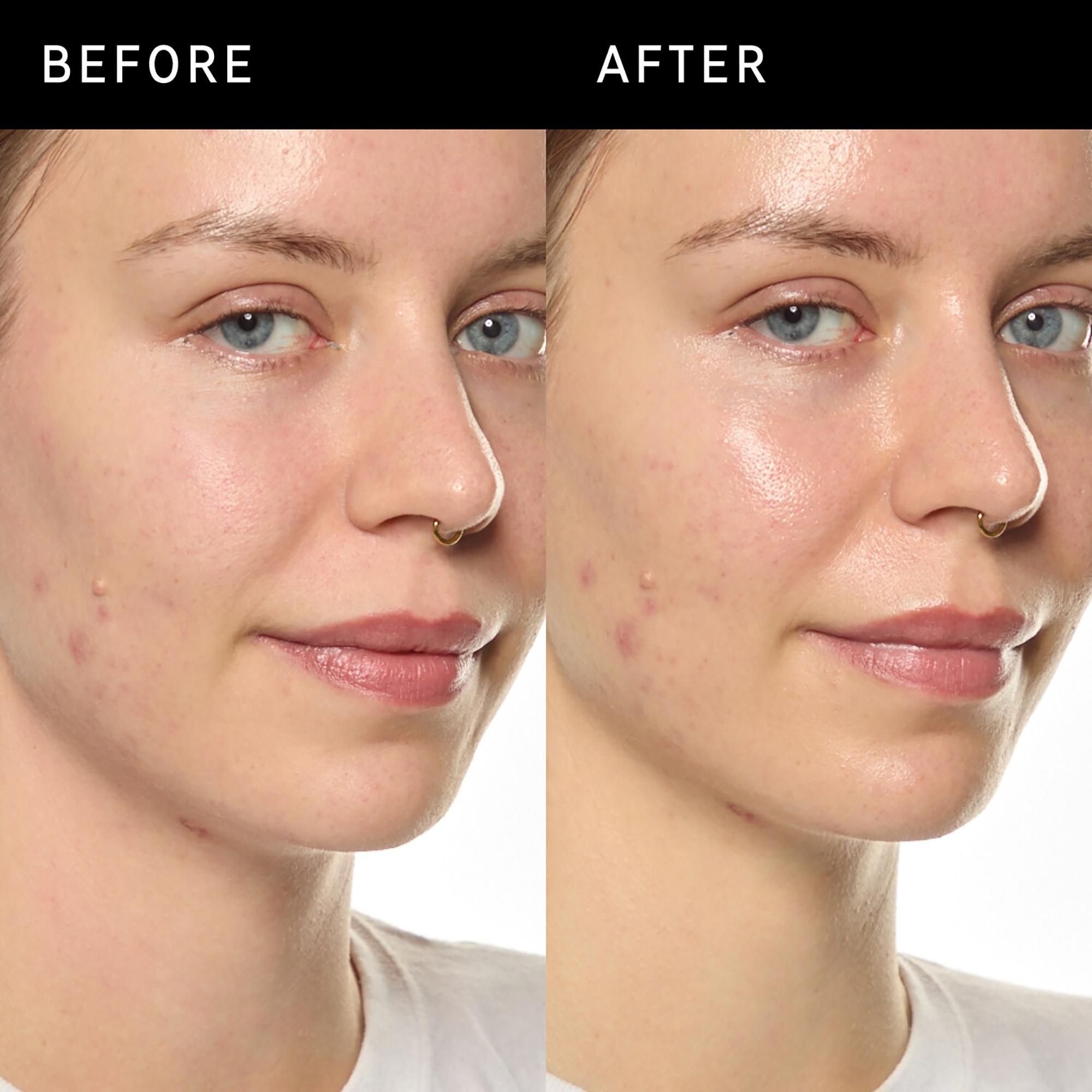 THE INKEY LIST  Ectoin Hydro-Barrier Serum - Siero Idratante e Protettivo 