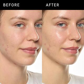 THE INKEY LIST  Ectoin Hydro-Barrier Serum - Siero Idratante e Protettivo 