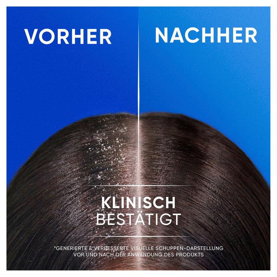 head & shoulders  Shampooing antipelliculaire Apple Fresh 2in1 